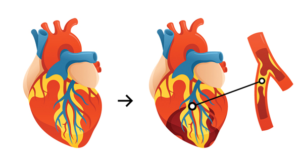 Chirurgien Cardio-vasculaire Nîmes